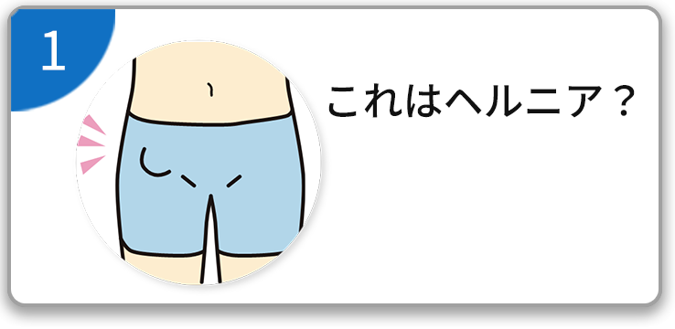 これはヘルニア？